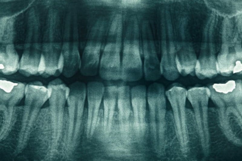 mercury filings