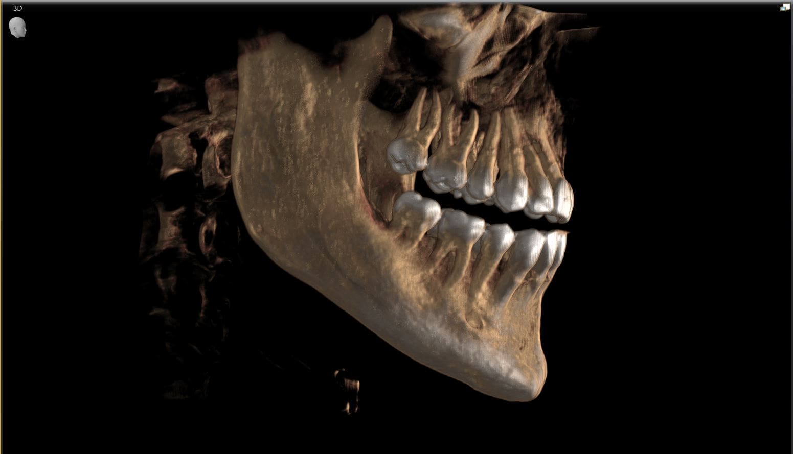 benefits of cone beam ct scan