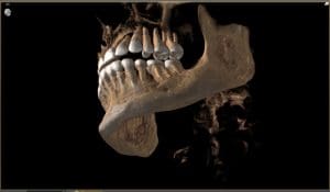 Cone Beam CT Scan