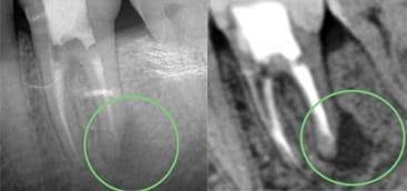 Cone beam CT scan