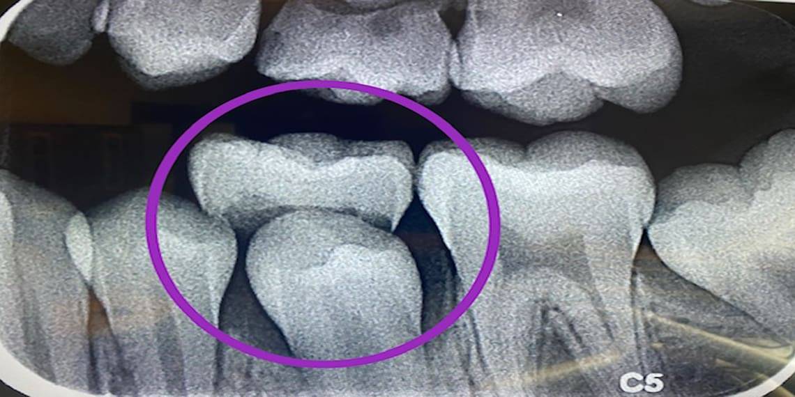More Than Just Practice teeth